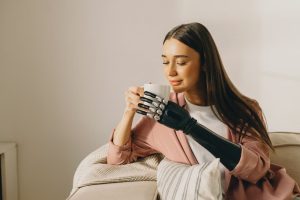 woman with amputation