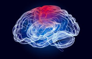 digital image of a damaged brain