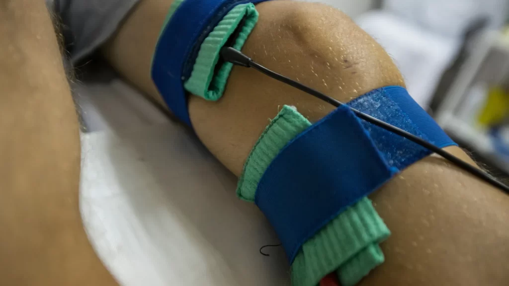 Dealing With Broken Bones And Fractures After A Car Accident image 2